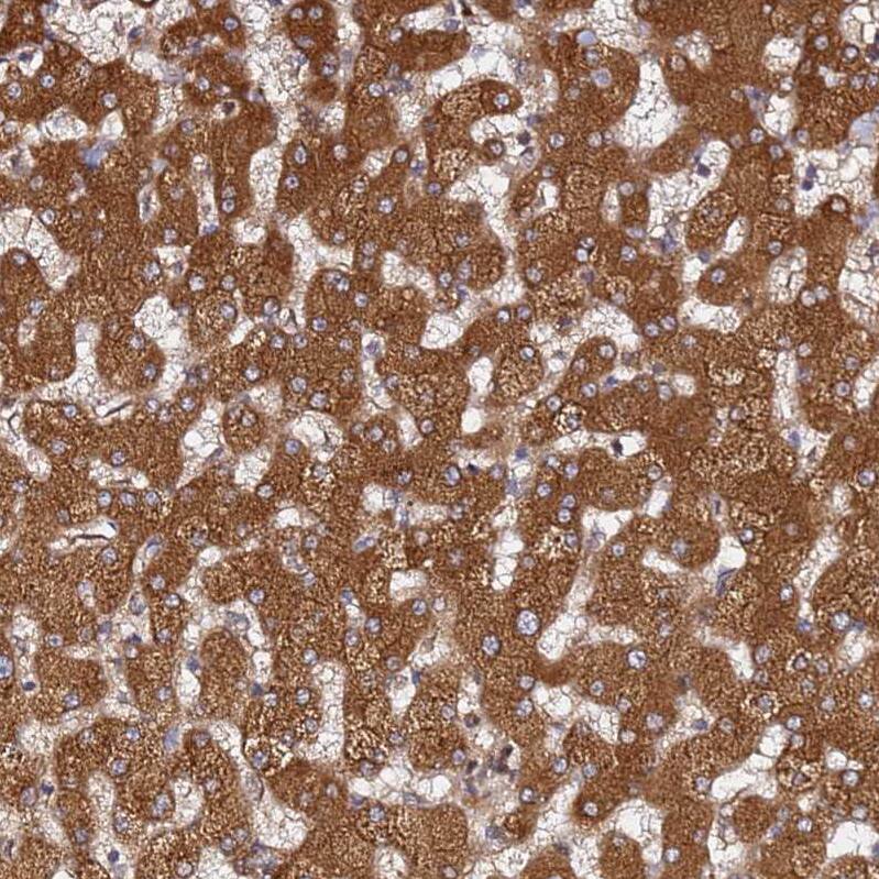 AMPK beta 2/PRKAB2 Antibody - BSA Free Immunohistochemistry: AMPK beta 2/PRKAB2 Antibody - BSA Free [NBP1-92286]