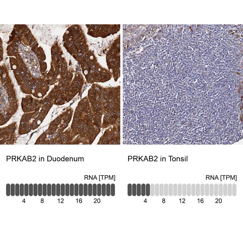 AMPK beta 2/PRKAB2 Antibody - BSA Free Immunohistochemistry: AMPK beta 2/PRKAB2 Antibody - BSA Free [NBP1-92286]