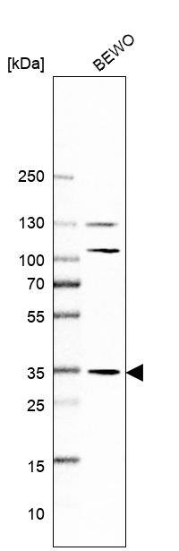 AMPK beta 2/PRKAB2 Antibody - BSA Free Western Blot: AMPK beta 2/PRKAB2 Antibody - BSA Free [NBP1-92286]