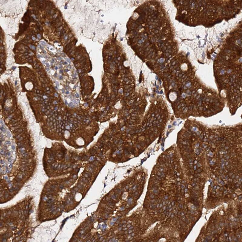 AMPK beta 2/PRKAB2 Antibody - BSA Free Immunohistochemistry: AMPK beta 2/PRKAB2 Antibody - BSA Free [NBP1-92286]