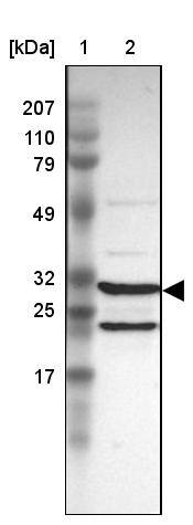 Proteasome 20S alpha 3 Antibody - BSA Free Western Blot: Proteasome 20S alpha 3 Antibody - BSA Free [NBP1-92293]