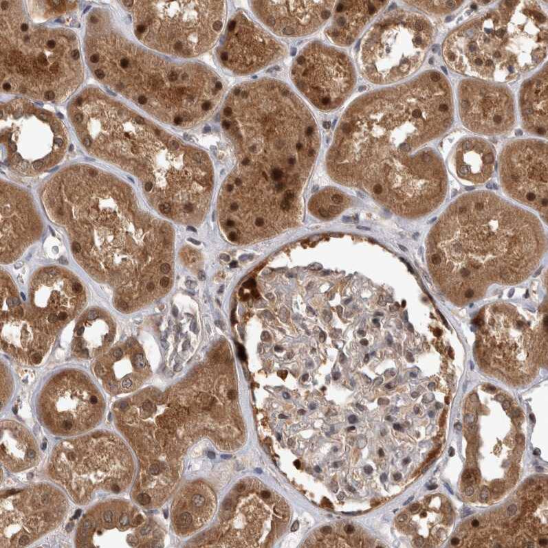 Proteasome 20S beta2 Antibody - BSA Free Immunohistochemistry: Proteasome 20S beta2 Antibody - BSA Free [NBP1-92294]