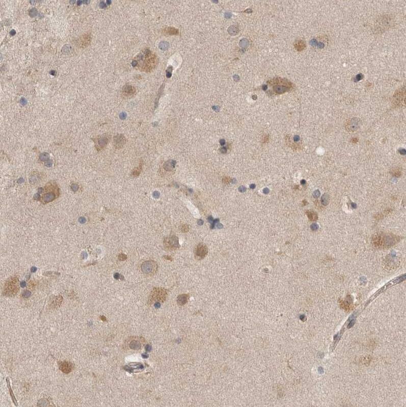 Proteasome 20S beta2 Antibody - BSA Free Immunohistochemistry: Proteasome 20S beta2 Antibody - BSA Free [NBP1-92294]