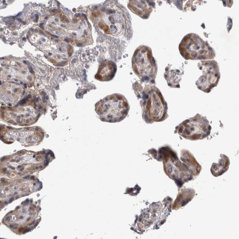 Proteasome 20S beta2 Antibody - BSA Free Immunohistochemistry: Proteasome 20S beta2 Antibody - BSA Free [NBP1-92294]