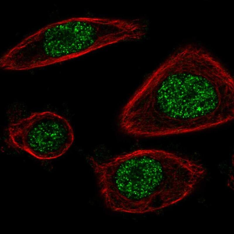 Proteasome 20S beta2 Antibody - BSA Free Immunocytochemistry/ Immunofluorescence: Proteasome 20S beta2 Antibody [NBP1-92295]
