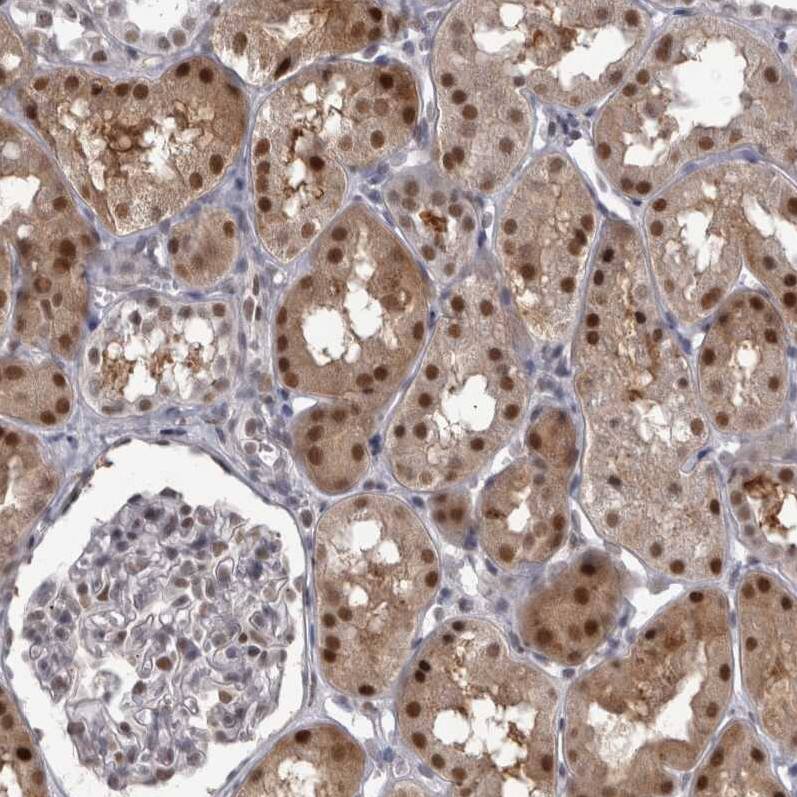 Proteasome 20S beta2 Antibody - BSA Free Immunohistochemistry: Proteasome 20S beta2 Antibody - BSA Free [NBP1-92295]