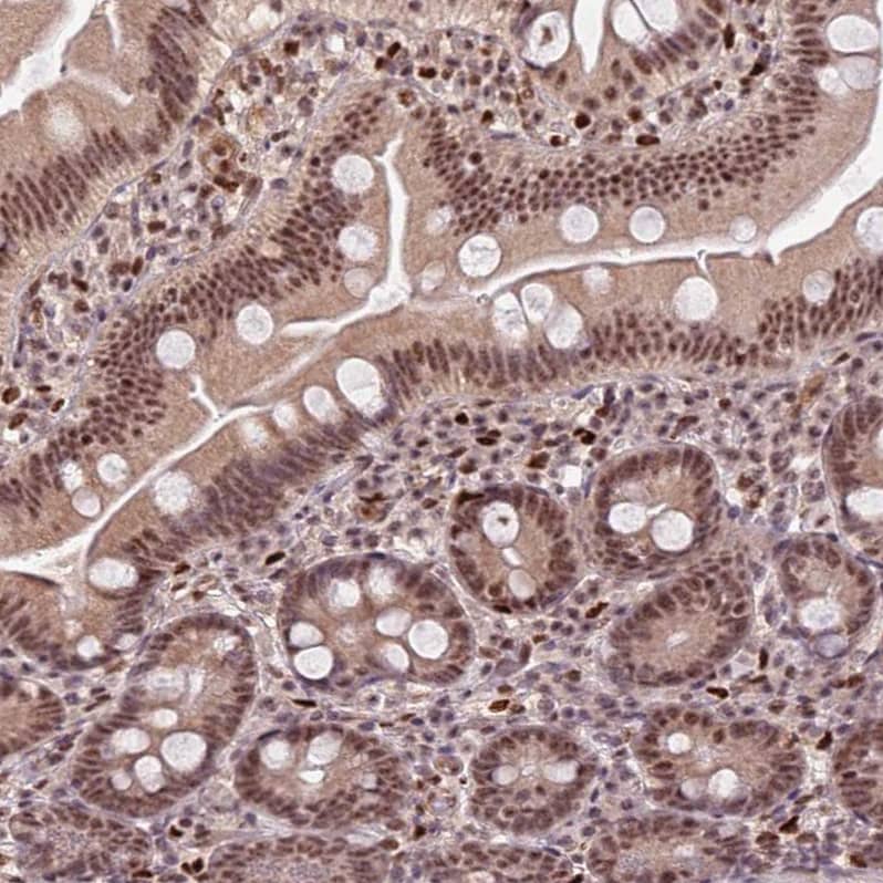 PRPF6 Antibody - BSA Free Immunohistochemistry: PRPF6 Antibody - BSA Free [NBP1-92298]