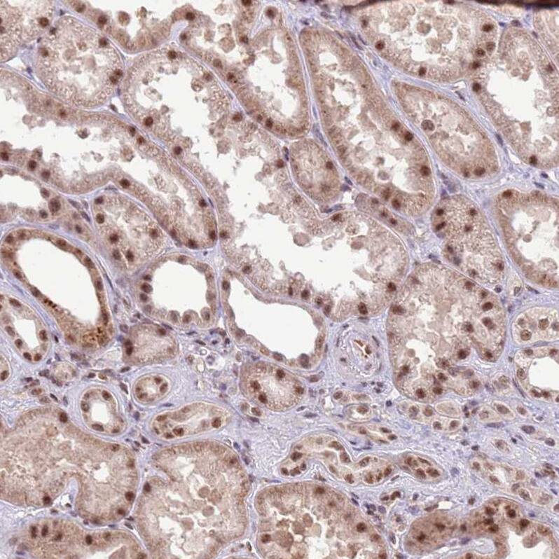 PRPF6 Antibody - BSA Free Immunohistochemistry: PRPF6 Antibody - BSA Free [NBP1-92298]