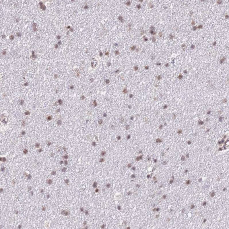 PRPF6 Antibody - BSA Free Immunohistochemistry: PRPF6 Antibody - BSA Free [NBP1-92298]