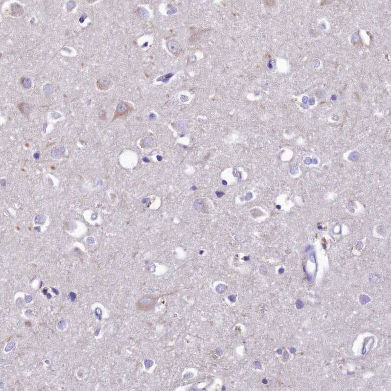 PTPRCAP Antibody - BSA Free Immunohistochemistry: PTPRCAP Antibody - BSA Free [NBP1-92304]