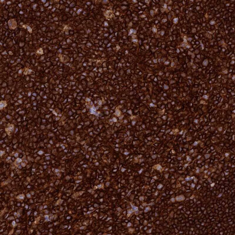 PTPRCAP Antibody - BSA Free Immunohistochemistry: PTPRCAP Antibody - BSA Free [NBP1-92304]