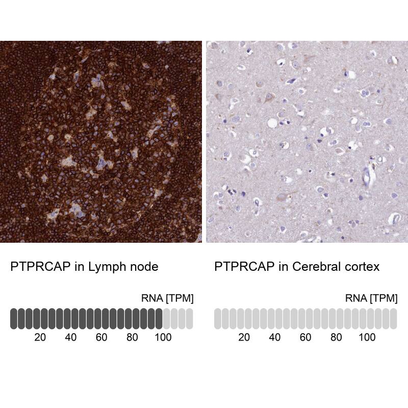 PTPRCAP Antibody - BSA Free Immunohistochemistry: PTPRCAP Antibody - BSA Free [NBP1-92304]