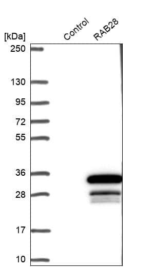 RAB28 Antibody - BSA Free Western Blot: RAB28 Antibody - BSA Free [NBP1-92308]