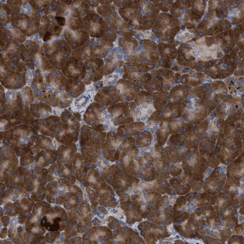 RAG1AP1 Antibody - BSA Free Immunohistochemistry: RAG1AP1 Antibody - BSA Free [NBP1-92311]