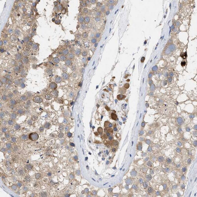 RAG1AP1 Antibody - BSA Free Immunohistochemistry: RAG1AP1 Antibody - BSA Free [NBP1-92311]