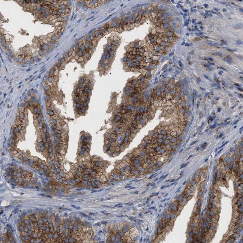 RAG1AP1 Antibody - BSA Free Immunohistochemistry: RAG1AP1 Antibody - BSA Free [NBP1-92311]