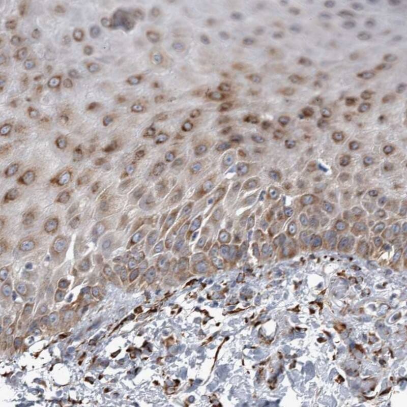 RAI16 Antibody - BSA Free Immunohistochemistry: RAI16 Antibody - BSA Free [NBP1-92313]