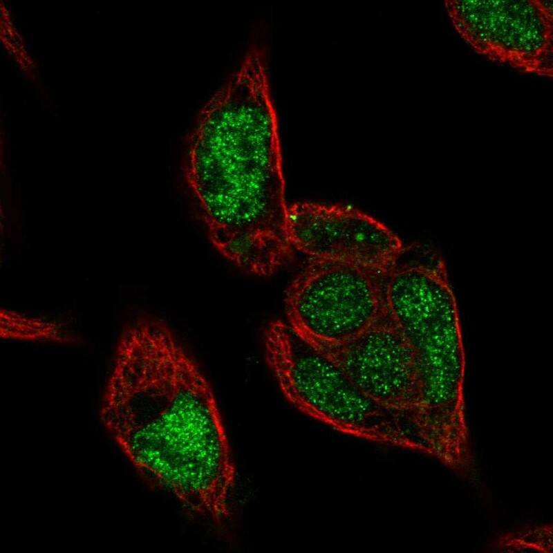 RCOR2 Antibody - BSA Free Immunocytochemistry/ Immunofluorescence: RCOR2 Antibody [NBP1-92323]