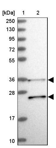 RDH13 Antibody - BSA Free Western Blot: RDH13 Antibody - BSA Free [NBP1-92324]