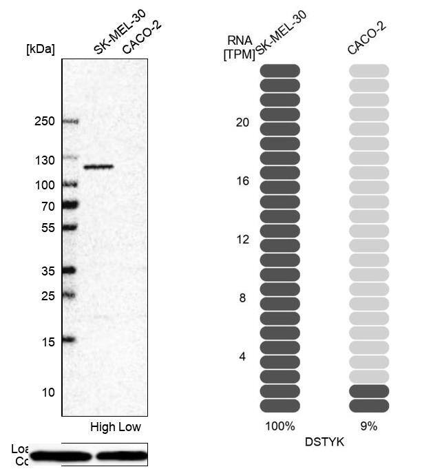 RIPK5 Antibody - BSA Free Western Blot: RIPK5 Antibody - BSA Free [NBP1-92336]