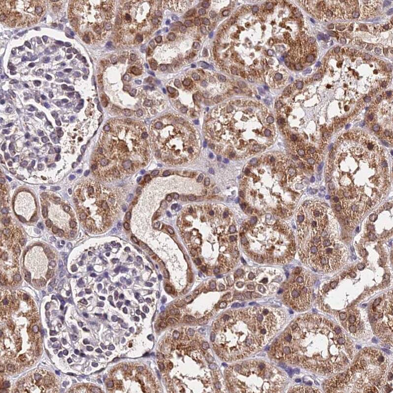 RNF121 Antibody - BSA Free Immunohistochemistry: RNF121 Antibody - BSA Free [NBP1-92339]
