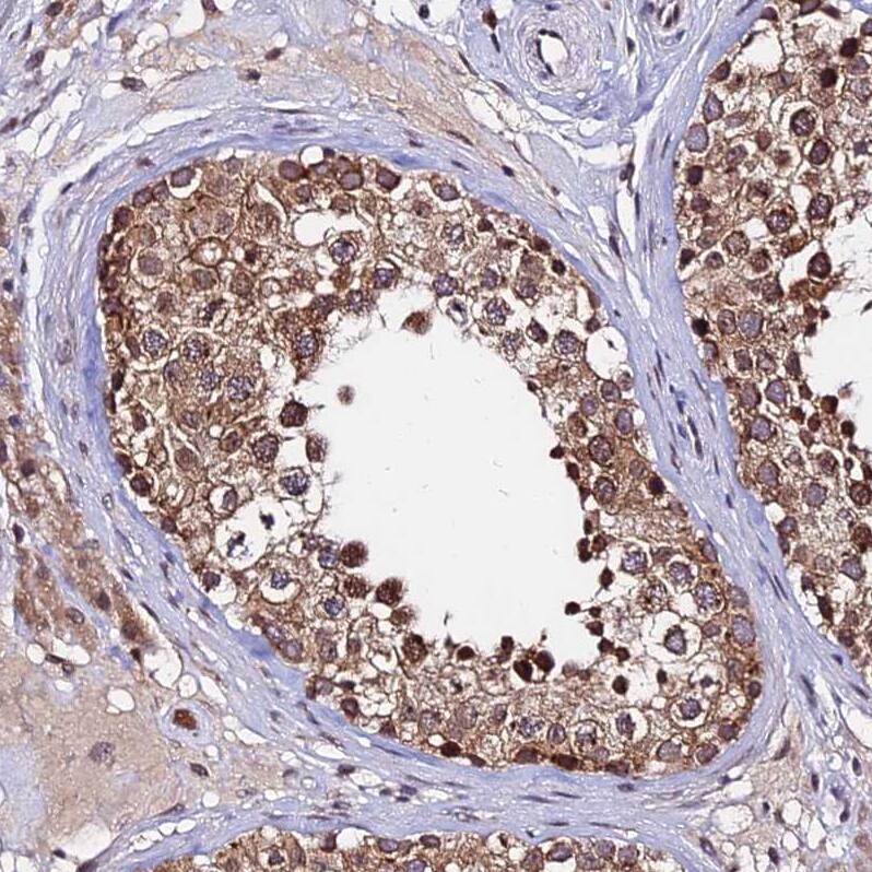 RNF121 Antibody - BSA Free Immunohistochemistry: RNF121 Antibody - BSA Free [NBP1-92339]