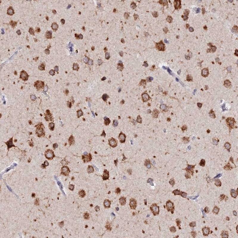 RNF121 Antibody - BSA Free Immunohistochemistry: RNF121 Antibody - BSA Free [NBP1-92339]