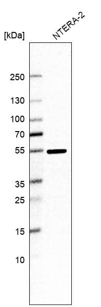 RNPS1 Antibody - BSA Free Western Blot: RNPS1 Antibody - BSA Free [NBP1-92343]