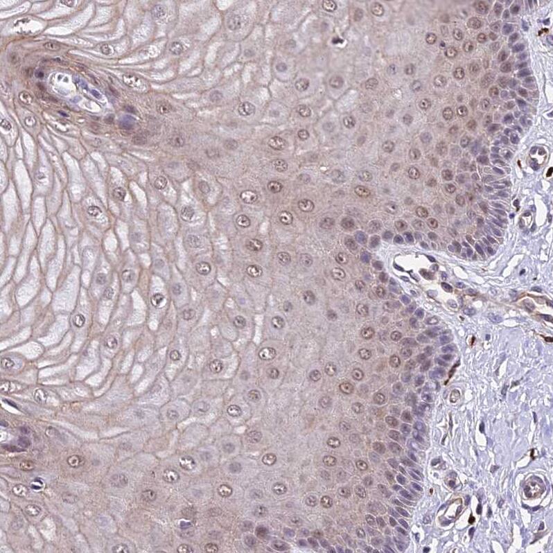 RPB9 Antibody - BSA Free Immunohistochemistry: RPB9 Antibody - BSA Free [NBP1-92344]