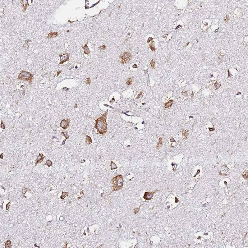 RPL13A Antibody - BSA Free Immunohistochemistry: RPL13A Antibody - BSA Free [NBP1-92345]