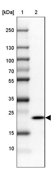 RPP25 Antibody - BSA Free Western Blot: RPP25 Antibody - BSA Free [NBP1-92349]