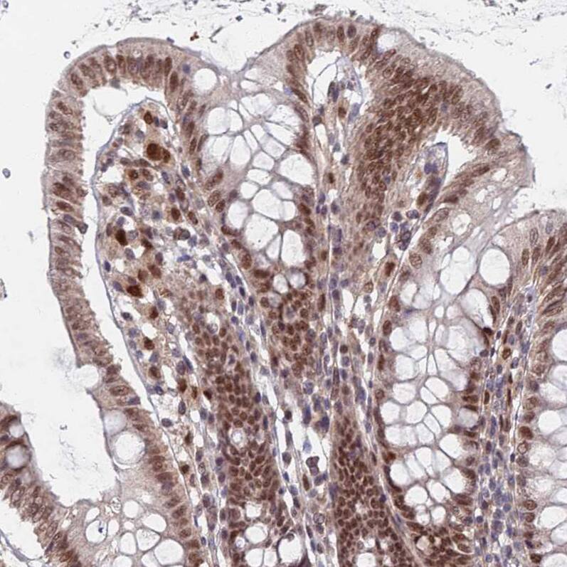RPP25 Antibody - BSA Free Immunohistochemistry: RPP25 Antibody - BSA Free [NBP1-92349]