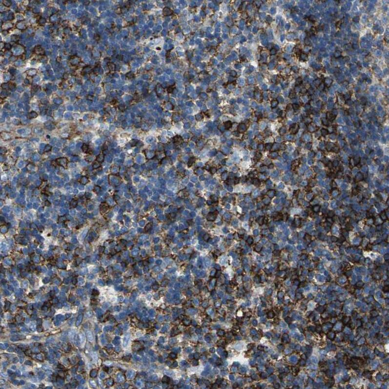 RPS13 Antibody - BSA Free Immunohistochemistry: RPS13 Antibody - BSA Free [NBP1-92350]