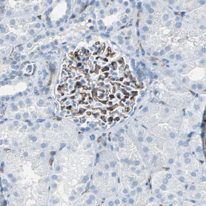 RPS13 Antibody - BSA Free Immunohistochemistry: RPS13 Antibody - BSA Free [NBP1-92350]