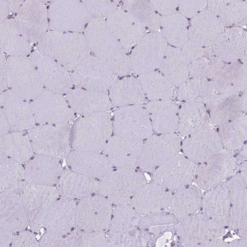 RPS26 Antibody - BSA Free Immunohistochemistry: RPS26 Antibody - BSA Free [NBP1-92352]