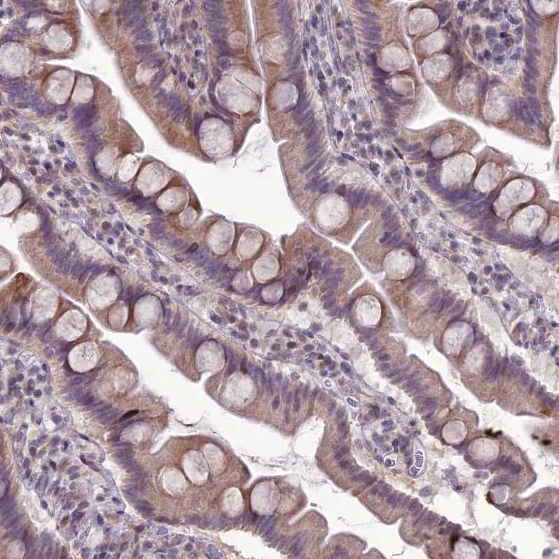 RPS26 Antibody - BSA Free Immunohistochemistry: RPS26 Antibody - BSA Free [NBP1-92352]