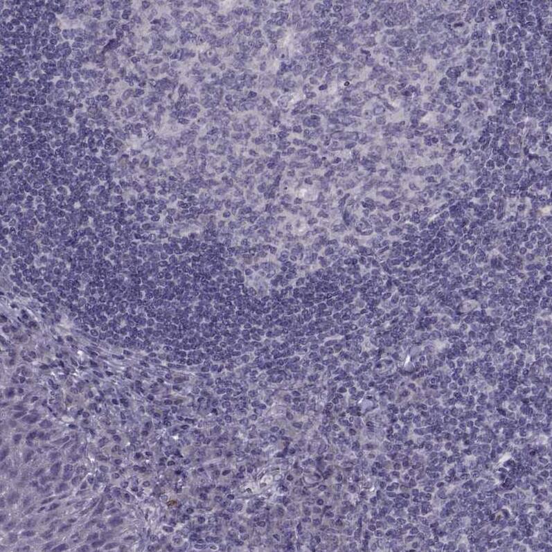 RSHL1 Antibody - BSA Free Immunohistochemistry: RSHL1 Antibody - BSA Free [NBP1-92356]