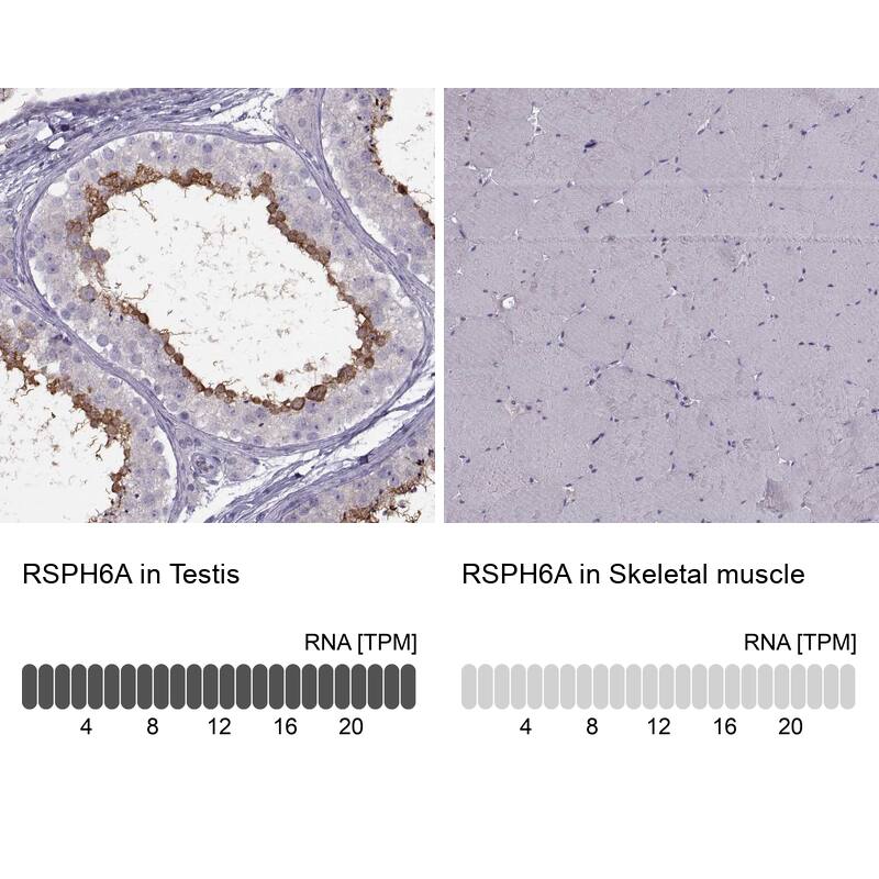 RSHL1 Antibody - BSA Free Immunohistochemistry: RSHL1 Antibody - BSA Free [NBP1-92356]