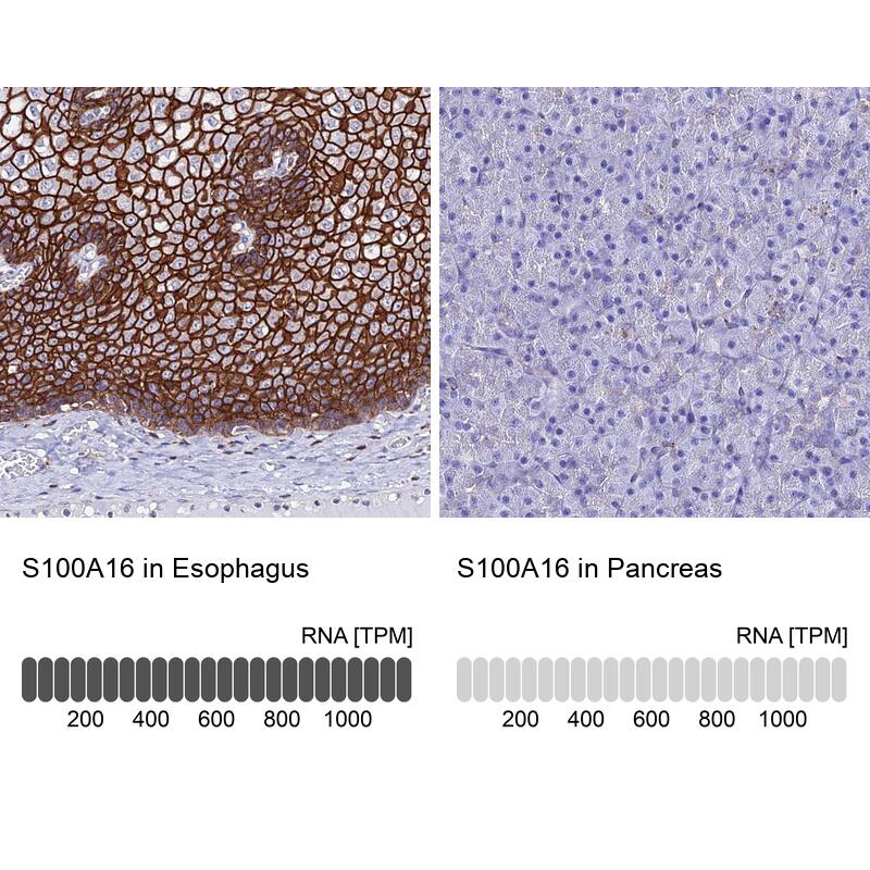 S100A16 Antibody - BSA Free Immunohistochemistry: S100A16 Antibody - BSA Free [NBP1-92361]