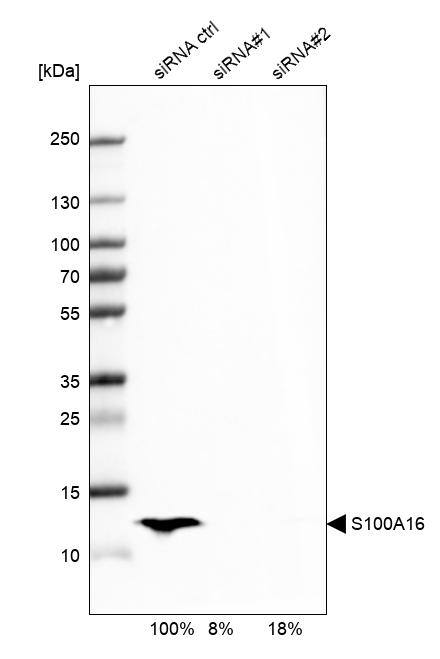 S100A16 Antibody - BSA Free Western Blot: S100A16 Antibody - BSA Free [NBP1-92361]