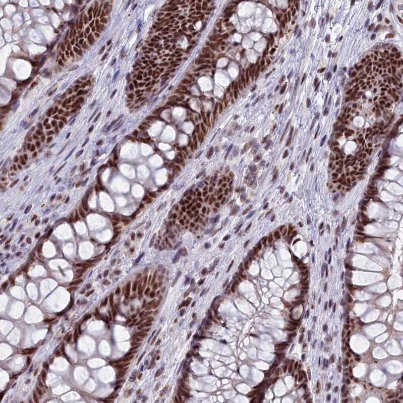 SAP130 Antibody - BSA Free Immunohistochemistry: SAP130 Antibody - BSA Free [NBP1-92362]