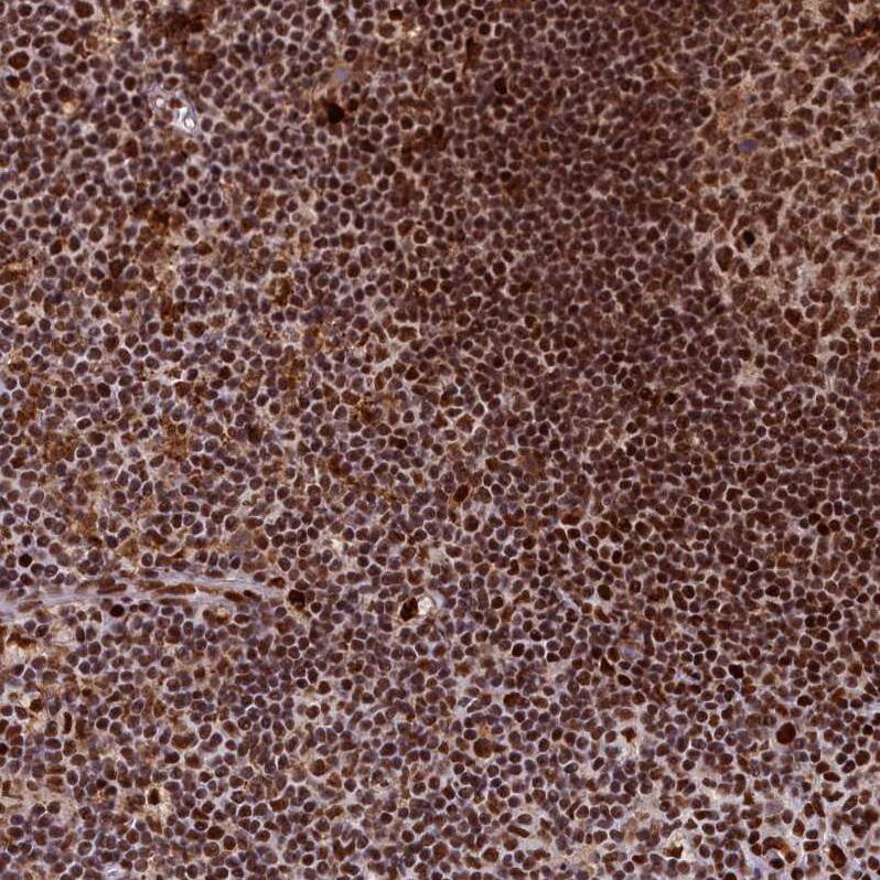 SAP130 Antibody - BSA Free Immunohistochemistry: SAP130 Antibody - BSA Free [NBP1-92362]