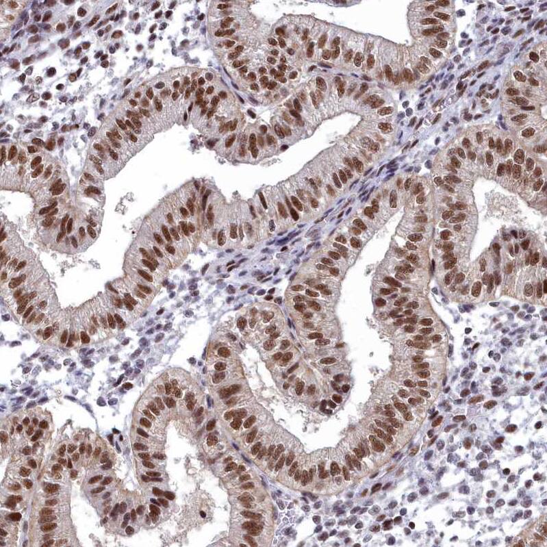 SAP130 Antibody - BSA Free Immunohistochemistry: SAP130 Antibody - BSA Free [NBP1-92362]
