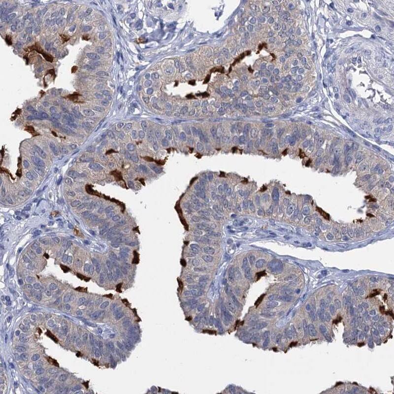 SARP Antibody - BSA Free Immunohistochemistry: SARP Antibody - BSA Free [NBP1-92363]