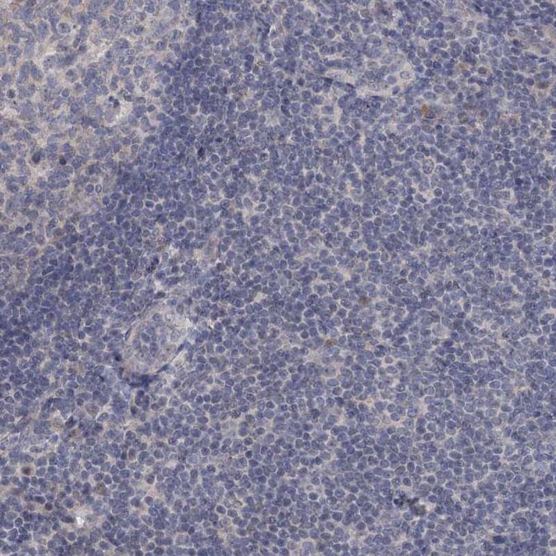 SBEM Antibody - BSA Free Immunohistochemistry: SBEM Antibody - BSA Free [NBP1-92366]