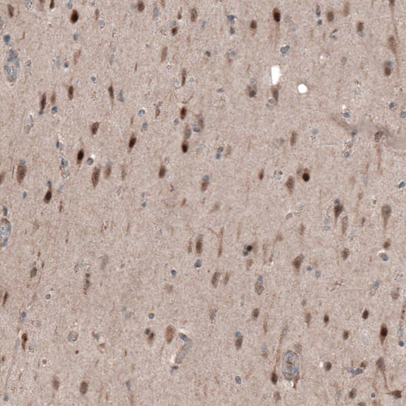 SCRT1 Antibody - BSA Free Immunohistochemistry: SCRT1 Antibody - BSA Free [NBP1-92369]