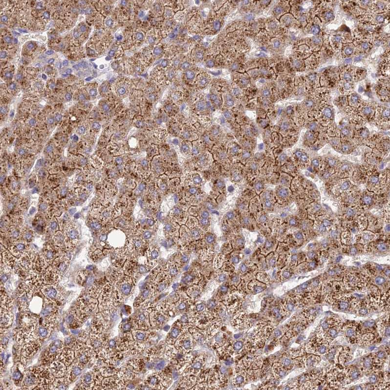 SDHD Antibody - BSA Free Immunohistochemistry: SDHD Antibody - BSA Free [NBP1-92372]