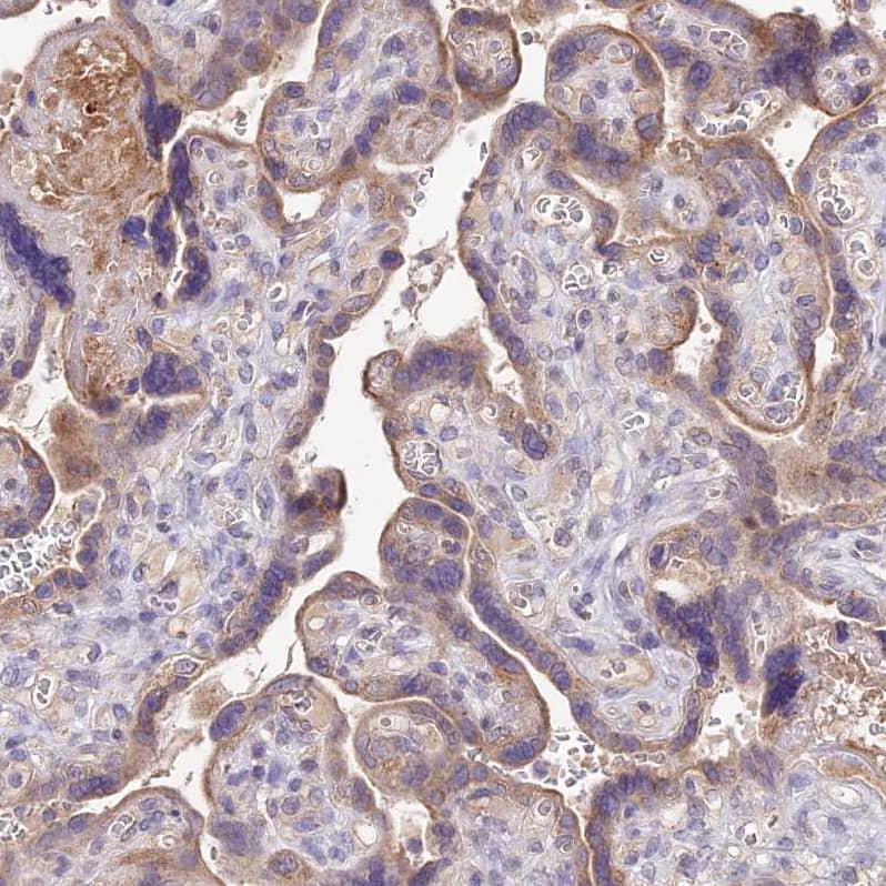SDHD Antibody - BSA Free Immunohistochemistry: SDHD Antibody - BSA Free [NBP1-92372]