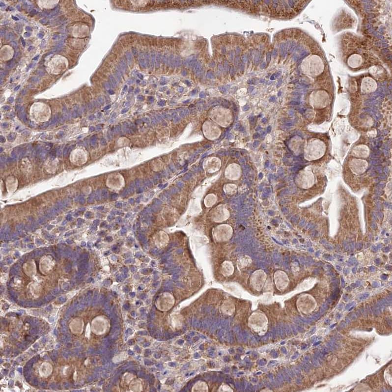 SDHD Antibody - BSA Free Immunohistochemistry: SDHD Antibody - BSA Free [NBP1-92372]