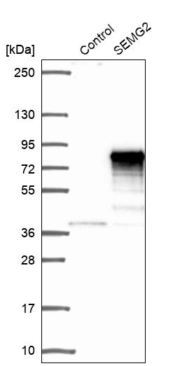 Semenogelin II Antibody - BSA Free Western Blot: Semenogelin II Antibody - BSA Free [NBP1-92377]